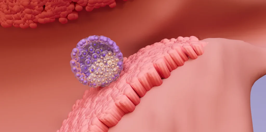 After Conception, How Long Does Implantation Take