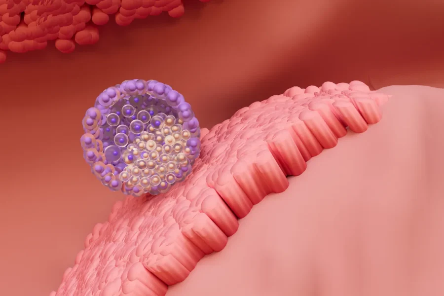 After Conception, How Long Does Implantation Take